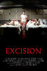 切除手术/Excision(2008)