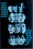 噩梦(2007)