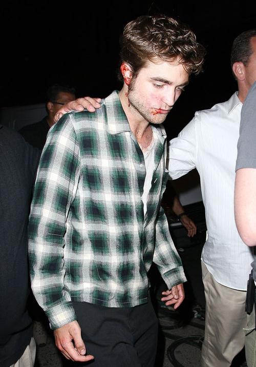 帕丁森新戏残妆满脸血迹神情颓丧–+Mtime时